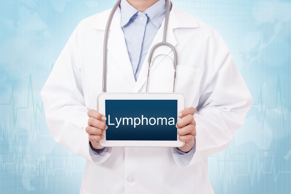 Important things to know about lymphoma