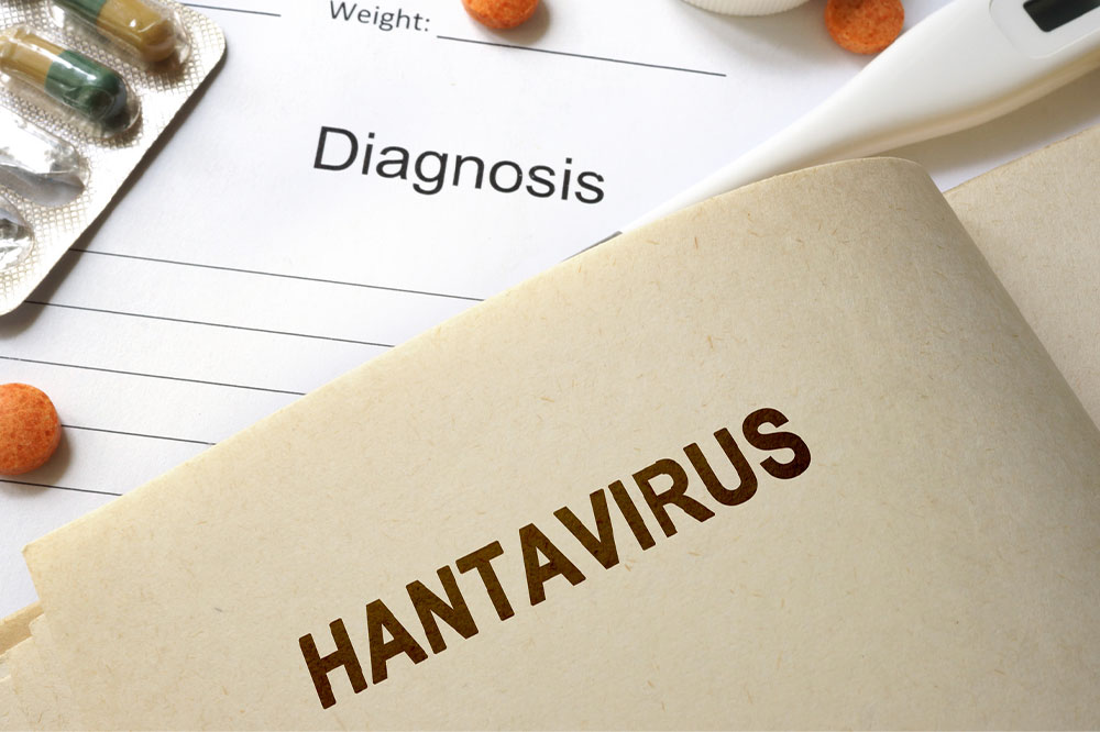 Hantavirus pulmonary syndrome &#8211; Causes and management