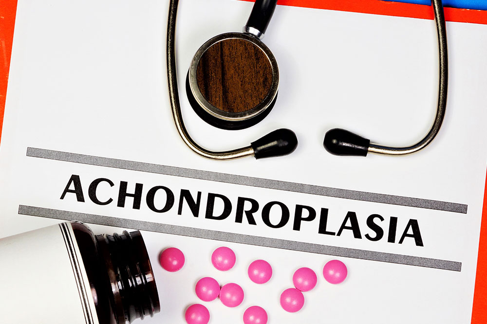 Achondroplasia Symptoms Causes And Management