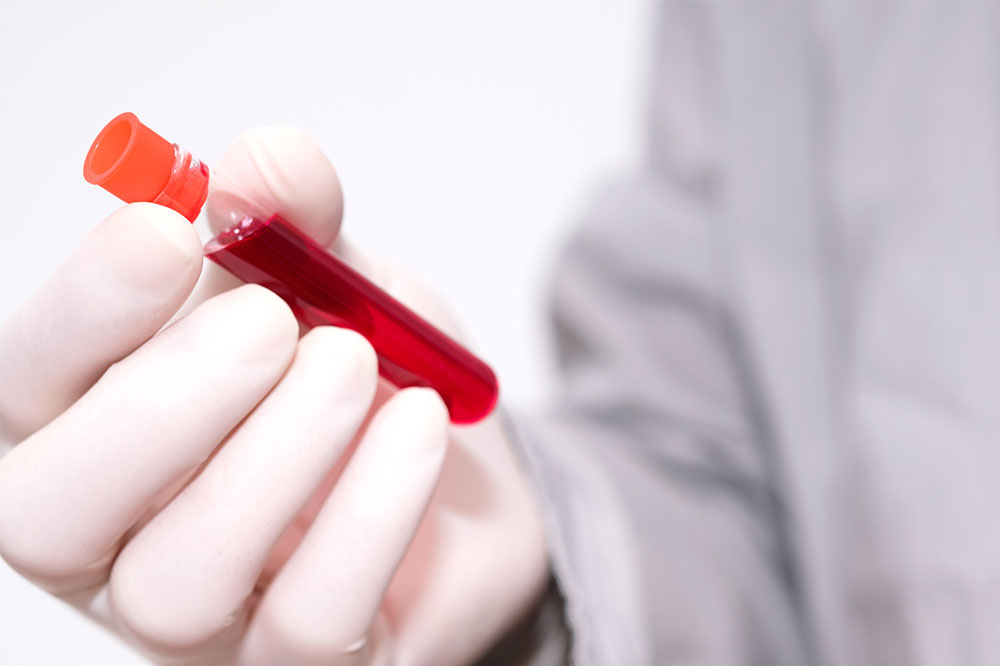 Learn about the various aspects of blood cancer