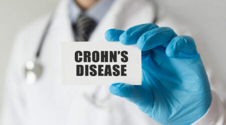 Essential things to know about the types of Crohn&#8217;s disease