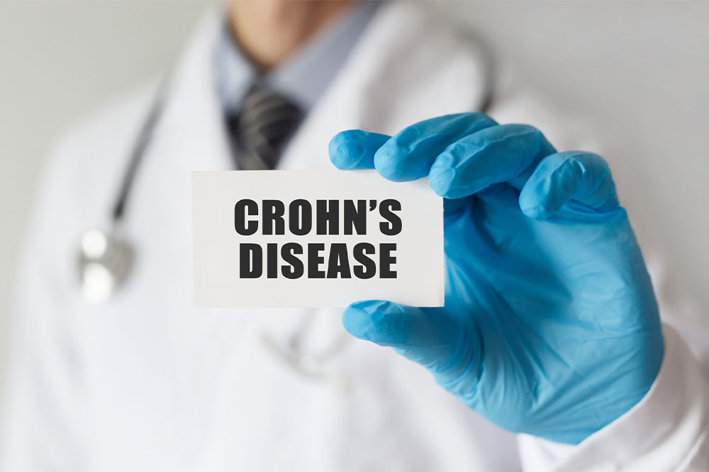 Essential things to know about the types of Crohn&#8217;s disease