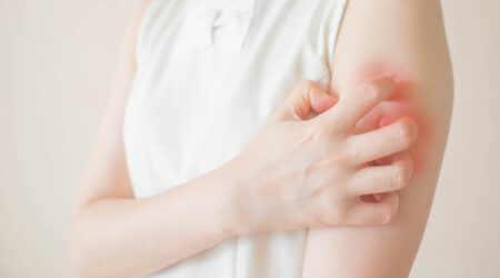 Types of skin rashes &#8211; Their symptoms and management