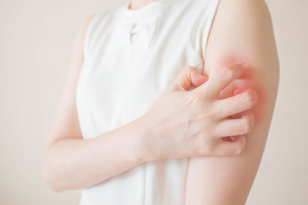 Types of skin rashes &#8211; Their symptoms and management