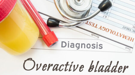 Overactive bladder &#8211; Signs and symptoms, causes, and management