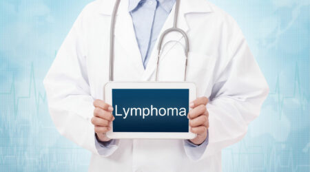 Important things to know about lymphoma