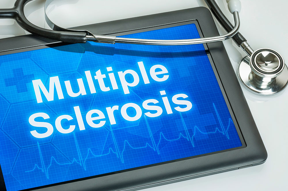 Multiple sclerosis &#8211; Types, signs, and risk factors of the condition