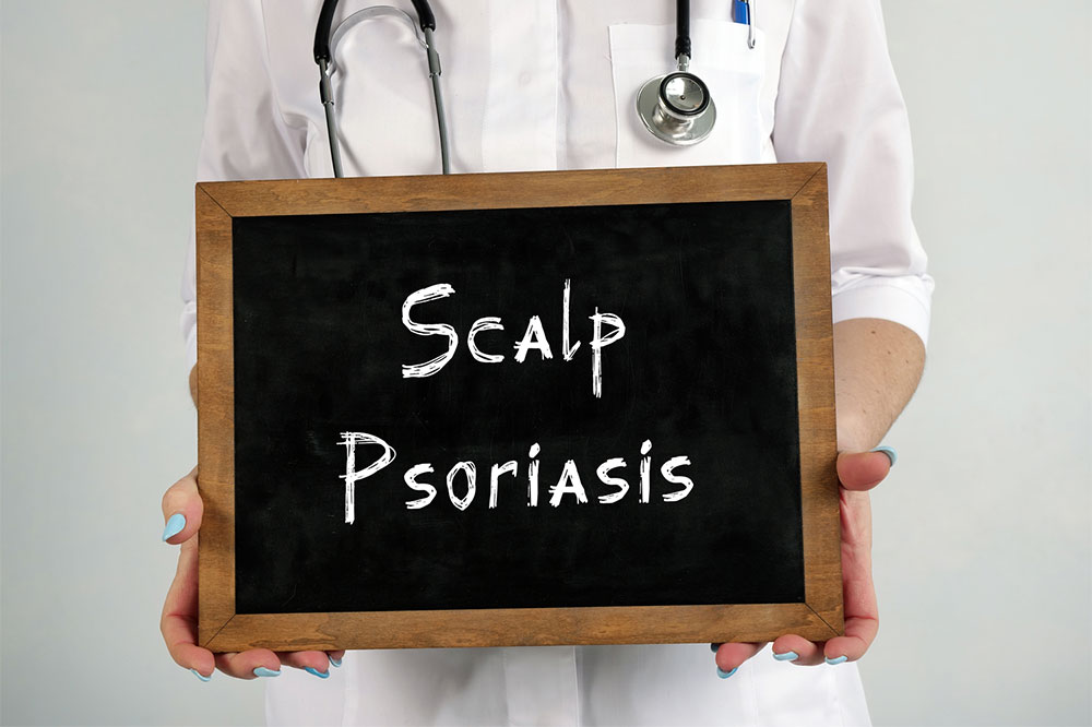 All one needs to know about scalp psoriasis