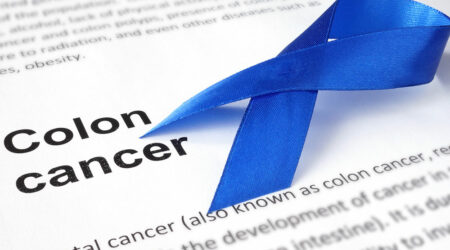 Colon cancer &#8211; Causes, symptoms, and more