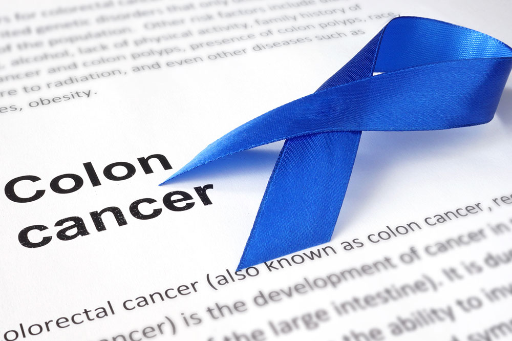 Colon cancer &#8211; Causes, symptoms, and more