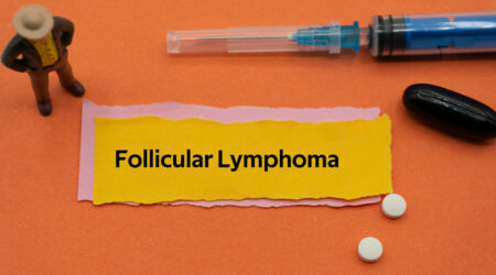 Follicular lymphoma &#8211; Causes, symptoms, diagnosis, and more