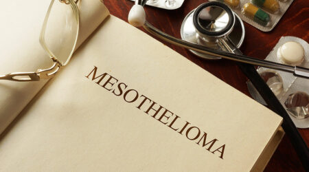 Mesothelioma &#8211; Symptoms, causes, and management options