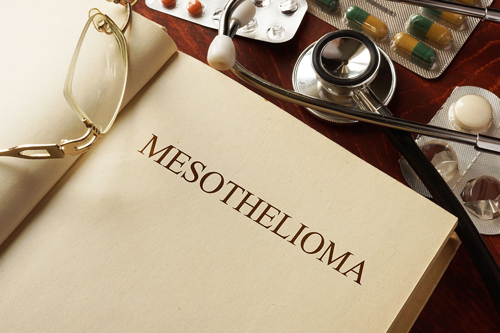 Mesothelioma &#8211; Symptoms, causes, and management options