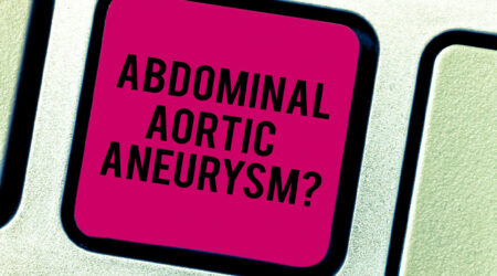 Abdominal aortic aneurysms &#8211; Causes, symptoms, risk factors, and more