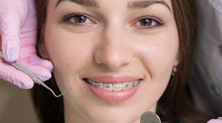 Benefits and types of teeth braces