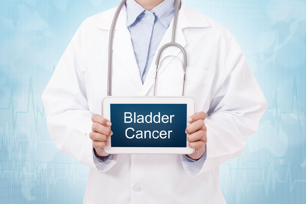 Bladder cancer &#8211; Signs and management options