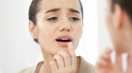 Everything to know about cold sores