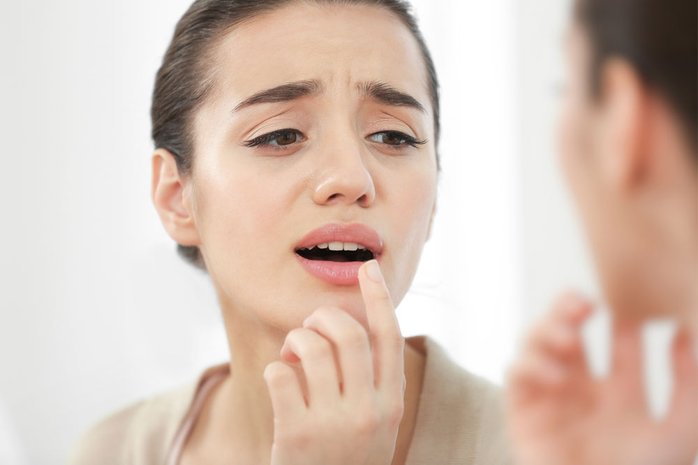 Everything to know about cold sores