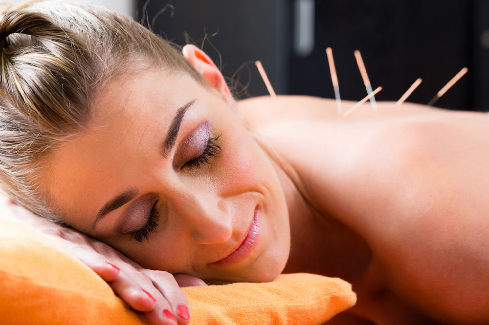 Key things to know about acupuncture