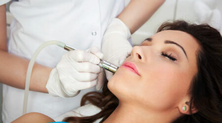 Key things to know about laser resurfacing for acne