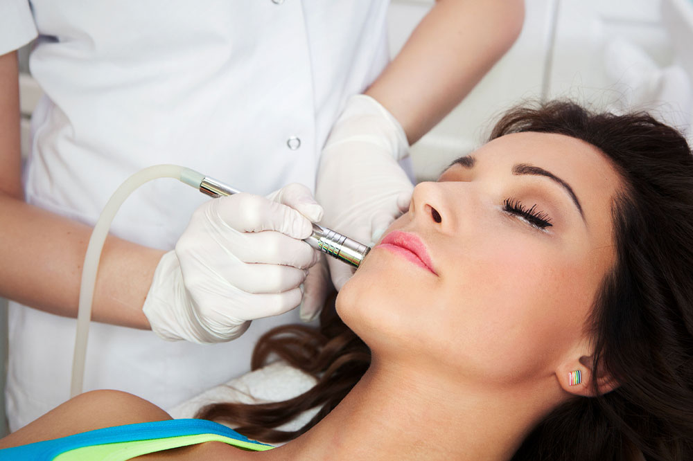 Key things to know about laser resurfacing for acne