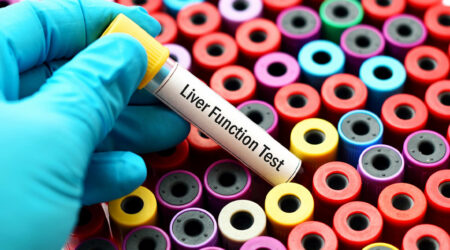 Liver function tests &#8211; Purpose, types, and procedure