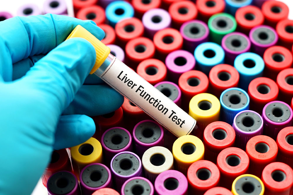 Liver function tests &#8211; Purpose, types, and procedure