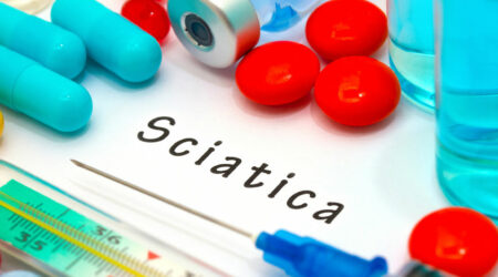 Sciatica &#8211; Causes, symptoms, diagnosis, and management