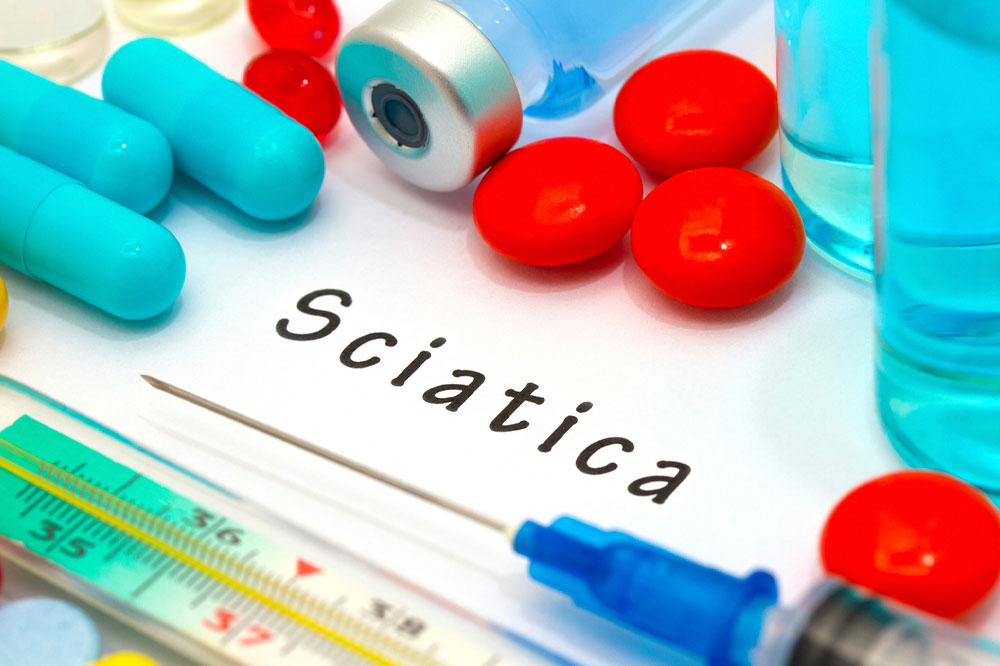 Sciatica &#8211; Causes, symptoms, diagnosis, and management