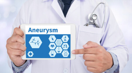 Symptoms, causes, and types of aneurysms