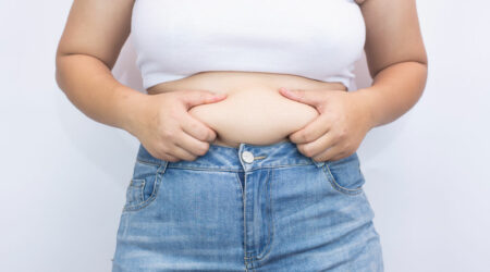 What causes abdominal fat and what to do about it