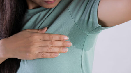 Hyperhidrosis &#8211; Causes and management options