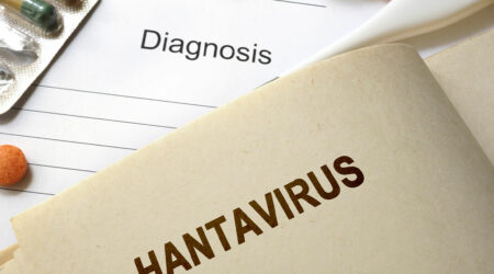 Hantavirus pulmonary syndrome &#8211; Causes and management