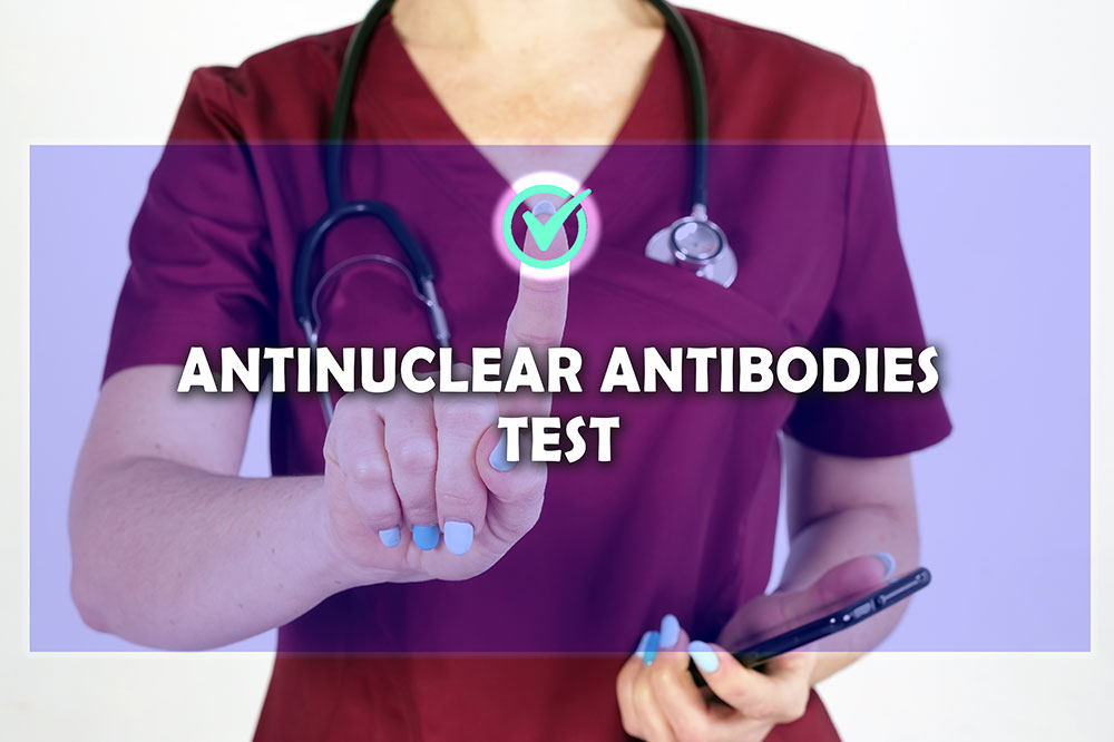 The purpose and procedure of an antinuclear antibody test