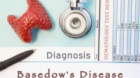 Understanding Basedow&#8217;s disease, its symptoms, and remedies