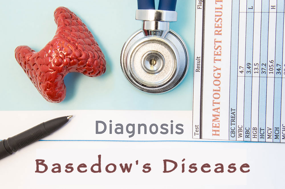 Understanding Basedow&#8217;s disease, its symptoms, and remedies