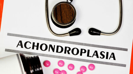 Achondroplasia &#8211; Symptoms, causes, and management