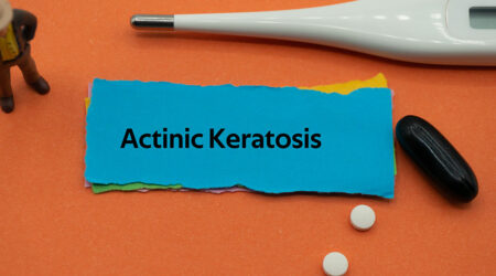 Actinic keratosis &#8211; What it is and its management