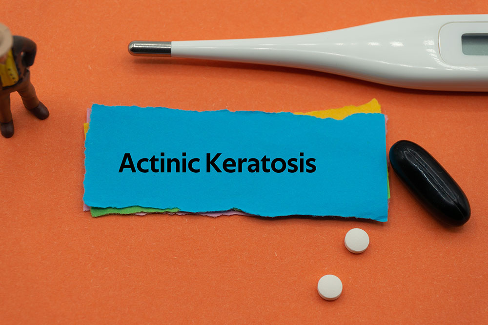 Actinic keratosis &#8211; What it is and its management