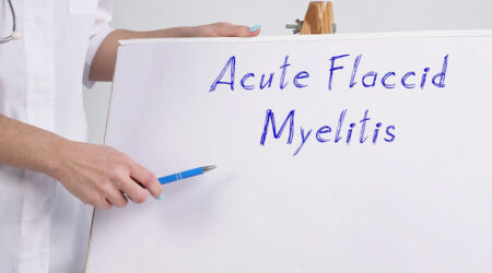 Acute flaccid myelitis- Warning signs, causes, and management