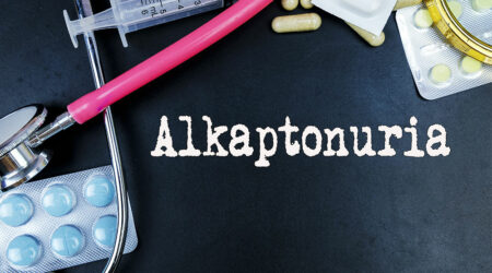 Alkaptonuria &#8211; What it is and its management