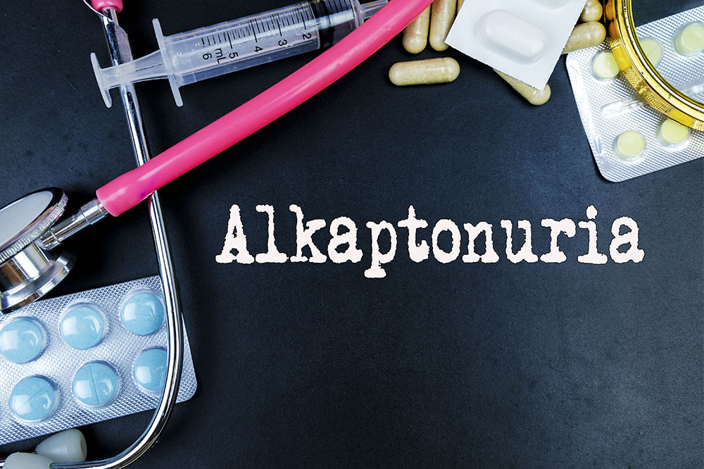 Alkaptonuria &#8211; What it is and its management