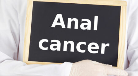 Anal cancer &#8211; Types, symptoms, causes, and management