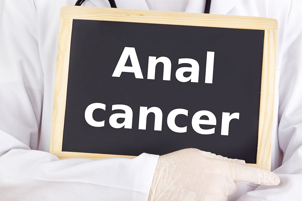 Anal cancer &#8211; Types, symptoms, causes, and management