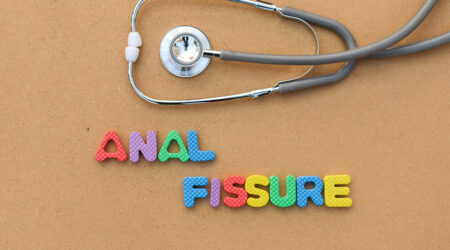 Anal fissure &#8211; Symptoms, causes, and management