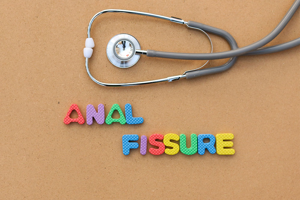 Anal fissure &#8211; Symptoms, causes, and management