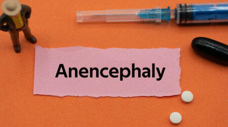 Anencephaly &#8211; Symptoms, causes, and more