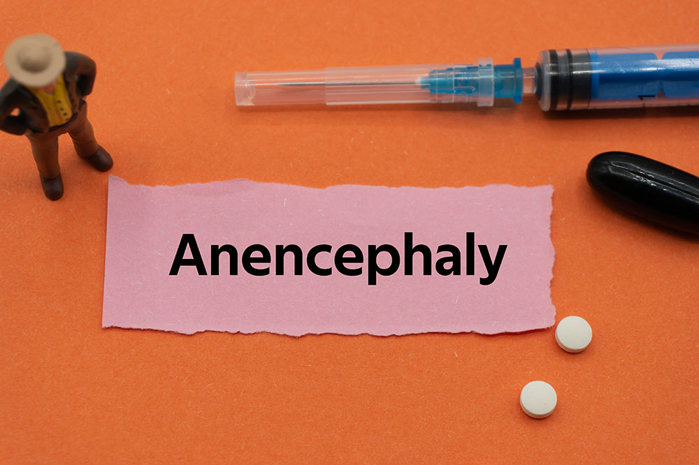 Anencephaly &#8211; Symptoms, causes, and more