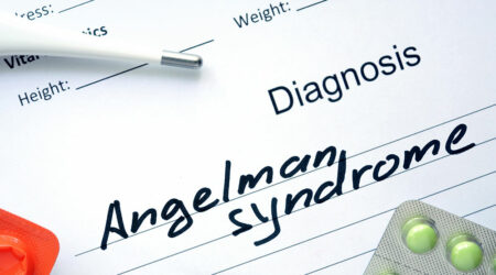 Angelman syndrome &#8211; Signs, causes, and management