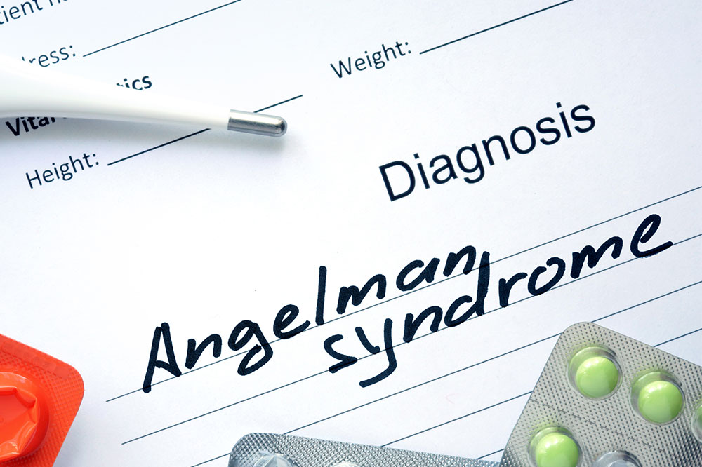 Angelman syndrome &#8211; Signs, causes, and management